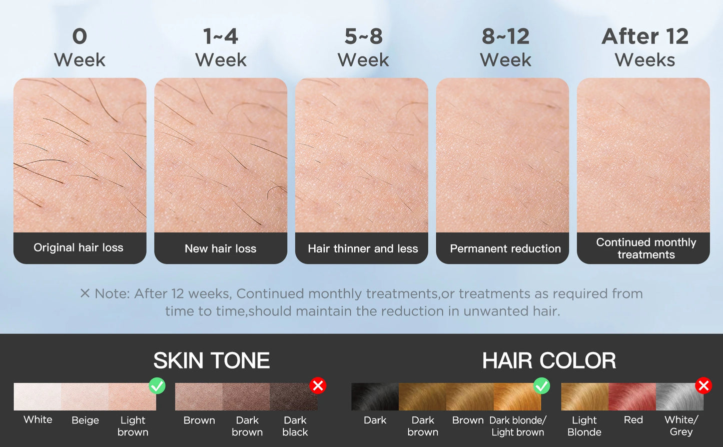 INNZA IPL Hair Removal Device – 999,999 Flashes with Ice Cooling