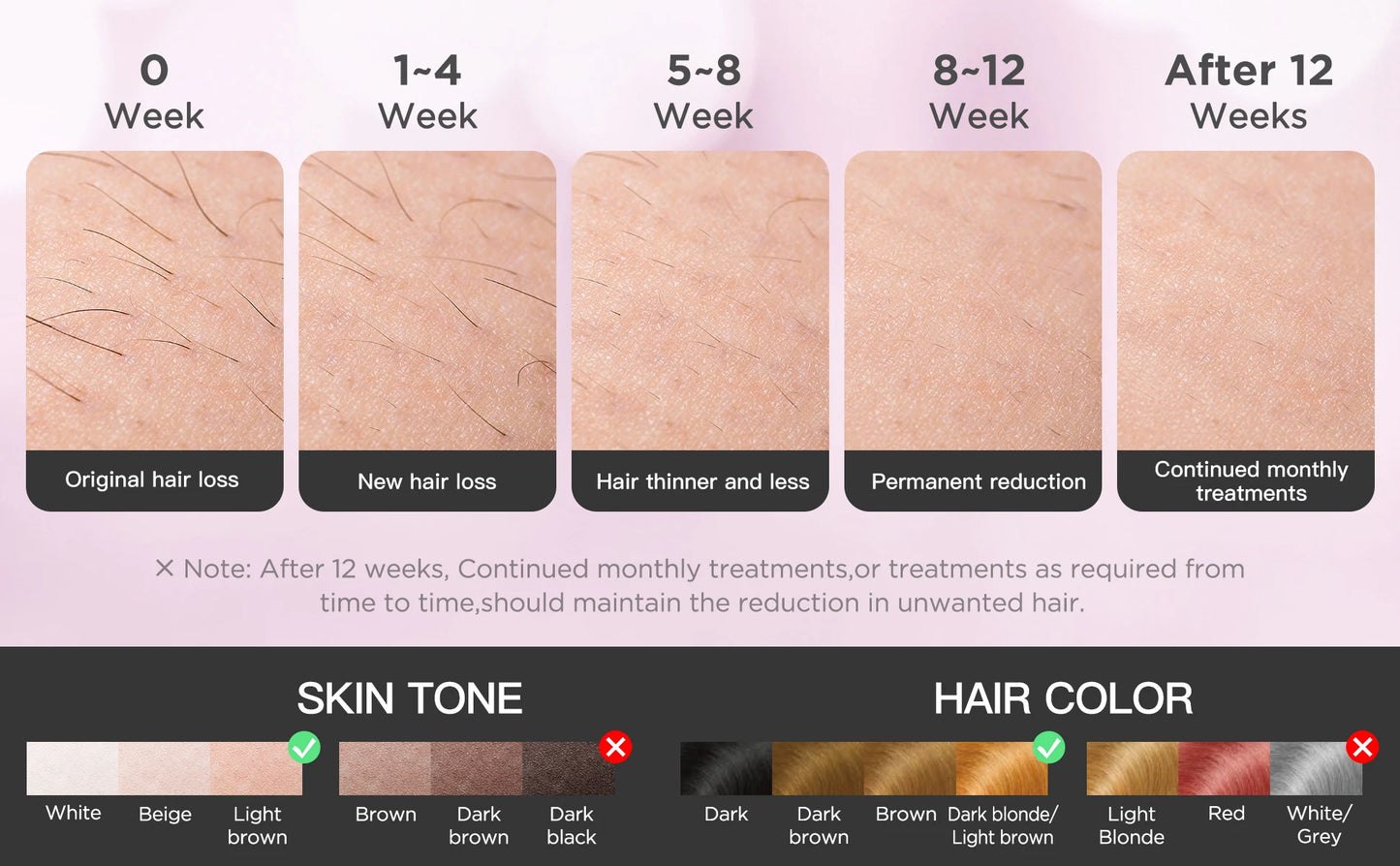 INNZA IPL Hair Removal Device – 999,999 Flashes with Ice Cooling