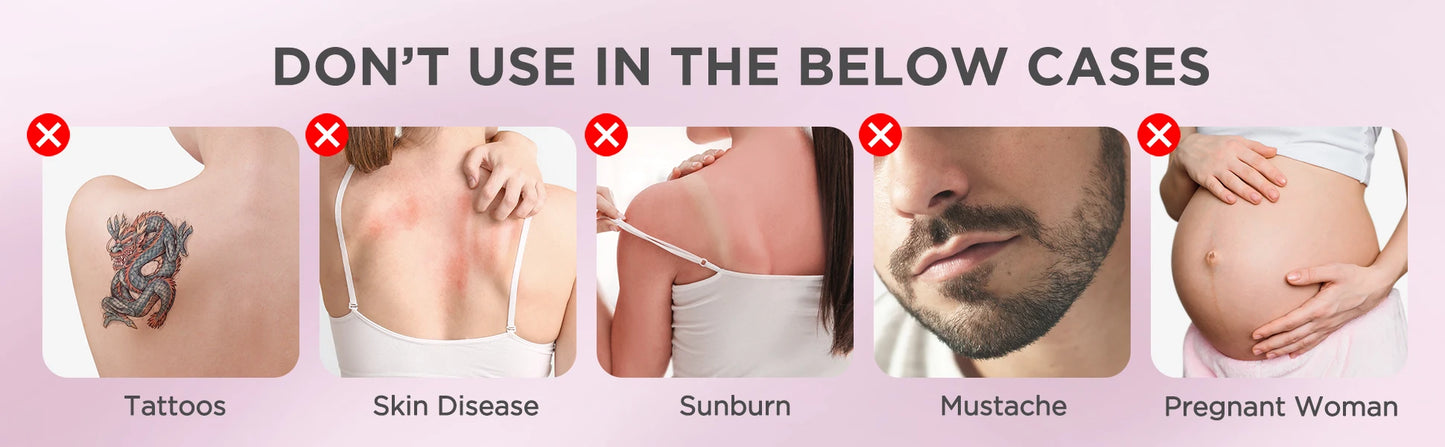 INNZA IPL Hair Removal Device – 999,999 Flashes with Ice Cooling